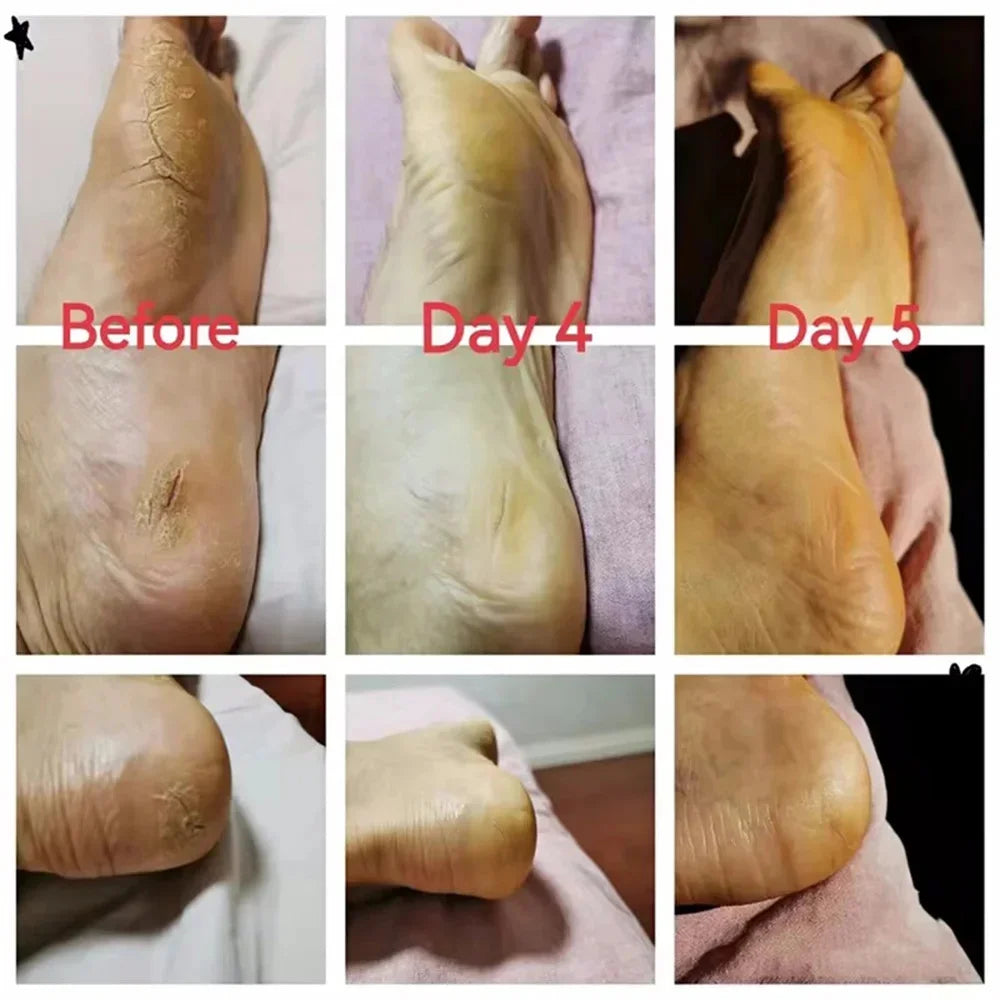 Herbal Foot Cream – Restores, Exfoliates and Moisturizes