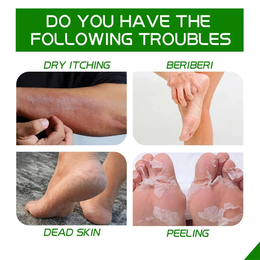 Herbal Foot Cream – Restores, Exfoliates and Moisturizes
