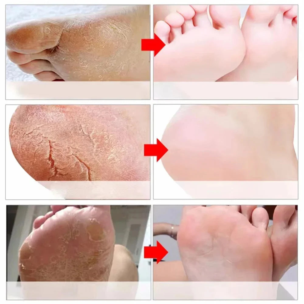 Herbal Foot Cream – Restores, Exfoliates and Moisturizes