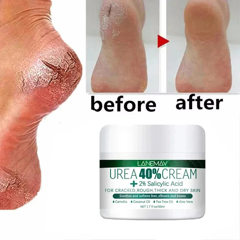 Herbal Foot Cream – Restores, Exfoliates and Moisturizes