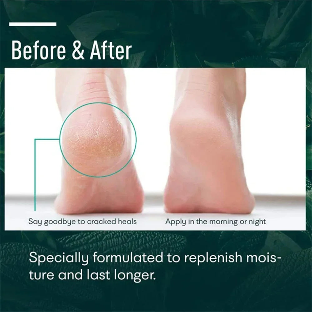 Herbal Foot Cream – Restores, Exfoliates and Moisturizes