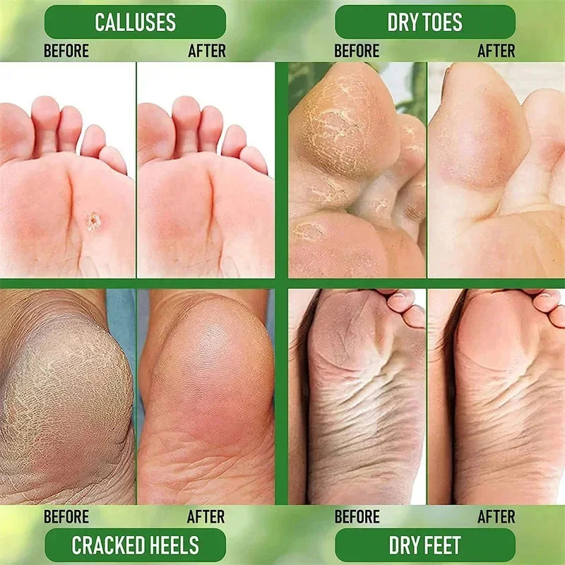 Herbal Foot Cream – Restores, Exfoliates and Moisturizes