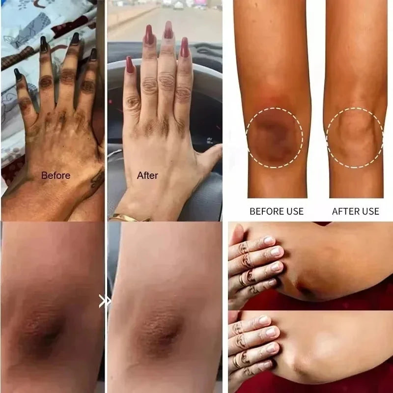 Body Whitening and Moisturizing Cream