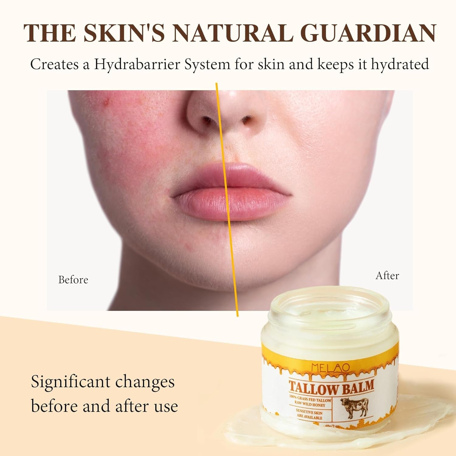 Tallow and Honey Balm, Beef Tallow for Skin, Natural Grass Fed Beef Tallow & Raw Wild Honey Balm, All-Natural Moisturizer for Face & Body, Tallow Balm for Skin Hydration, 2Oz (Honey, 1 Bottle)